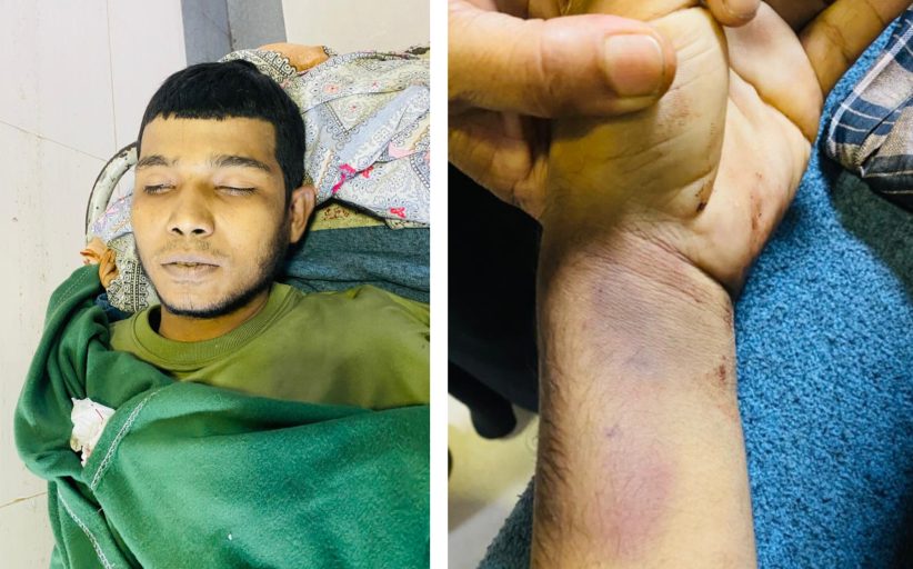 চট্টগ্রামের কর্ণেলহাটস্থ বিশ্ব কলোনীর বিএনপি অফিসে ডেকে নিয়ে রাকিব(২০) নামের এক যুবককে নির্যাতনের অভিযোগ উঠেছে