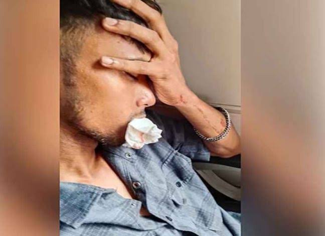 কক্সবাজার রুটে চলাচলরত ট্রেনে পাথর নিক্ষেপে দাঁত ভেঙ্গেছে যাত্রীর