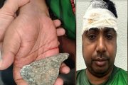 চলন্ত ট্রেনে পাথর, মাথা ফেটে রক্তাক্ত যাত্রী; চিকিৎসকের খোঁজে মাইকিং