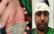 চলন্ত ট্রেনে পাথর, মাথা ফেটে রক্তাক্ত যাত্রী; চিকিৎসকের খোঁজে মাইকিং