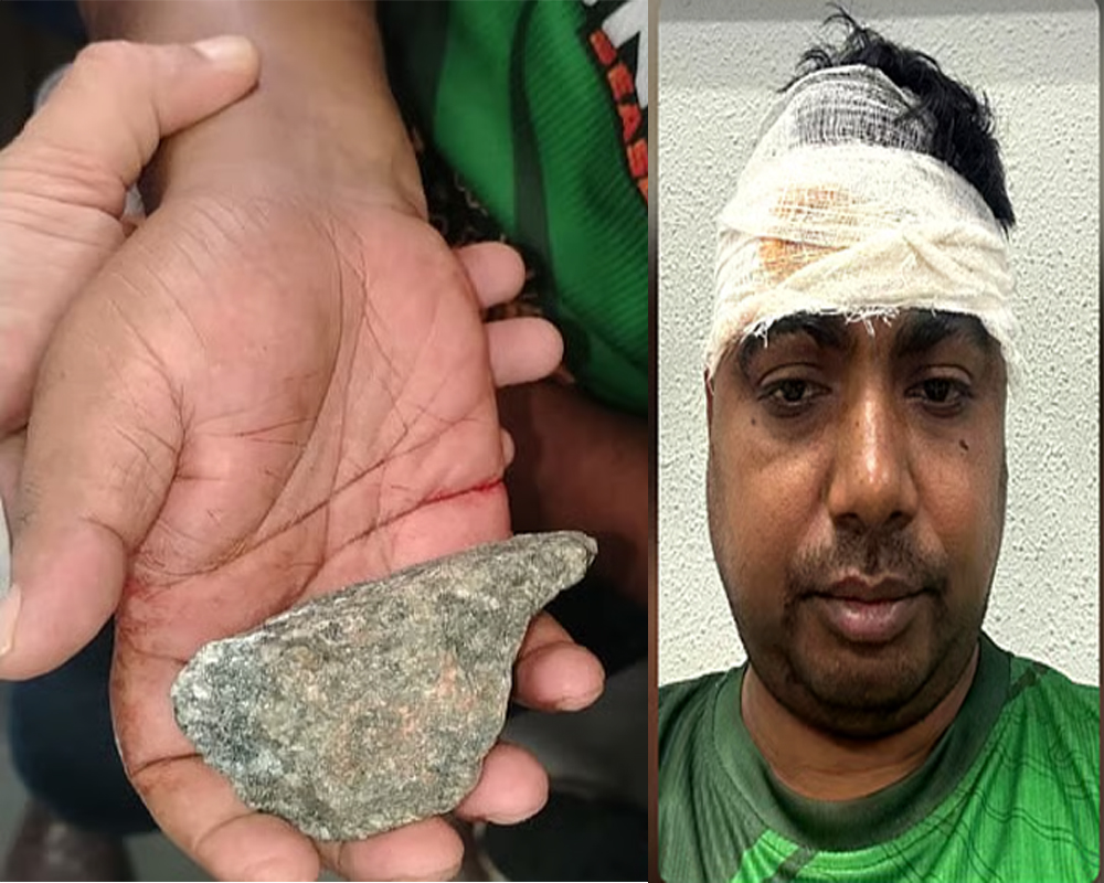 চলন্ত ট্রেনে পাথর, মাথা ফেটে রক্তাক্ত যাত্রী; চিকিৎসকের খোঁজে মাইকিং